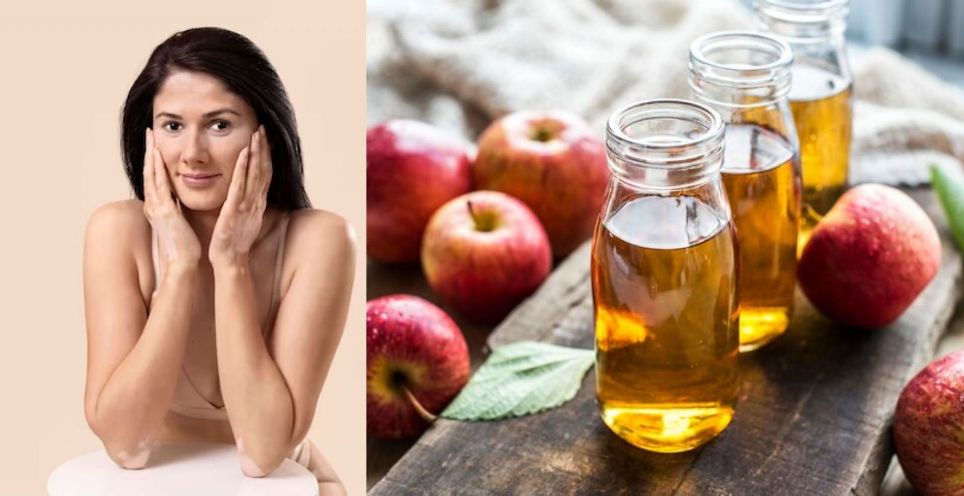 Beauty benefits of Apple cider vinegar