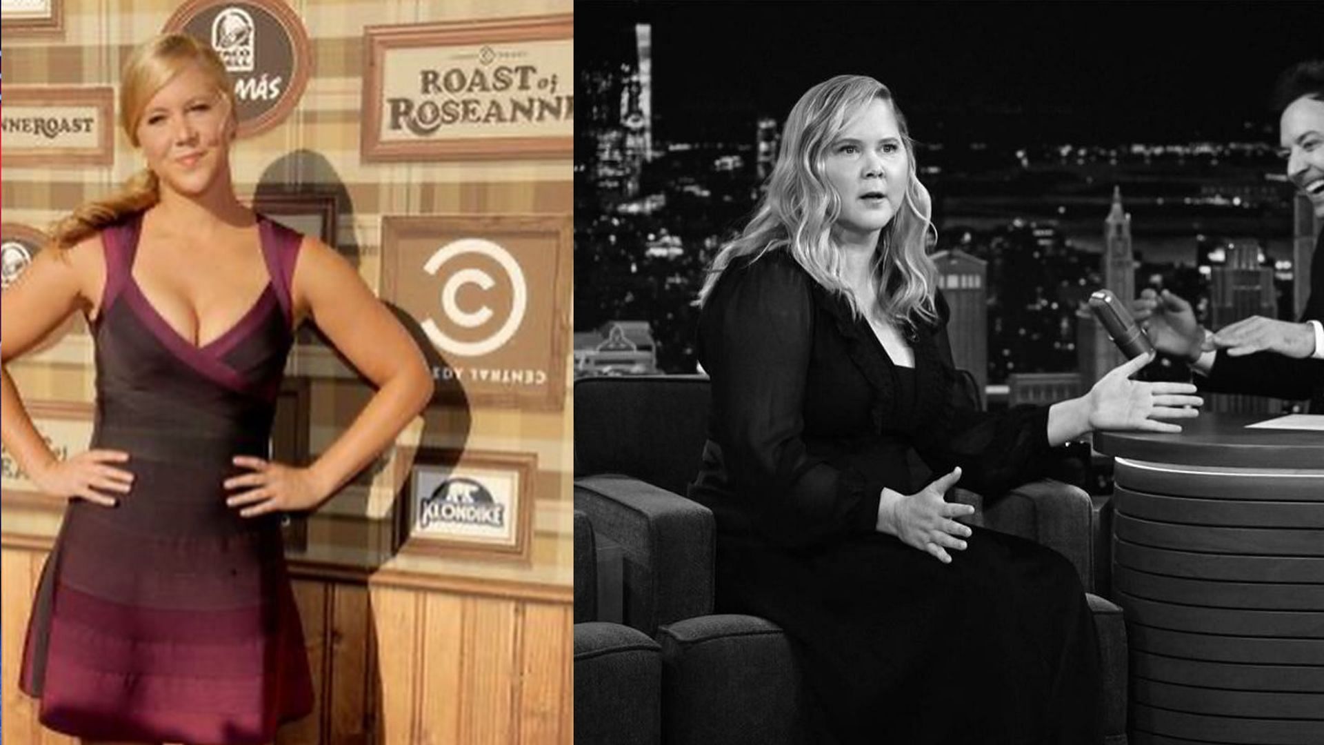 Amy schumer endometriosis (image sourced via instagram)