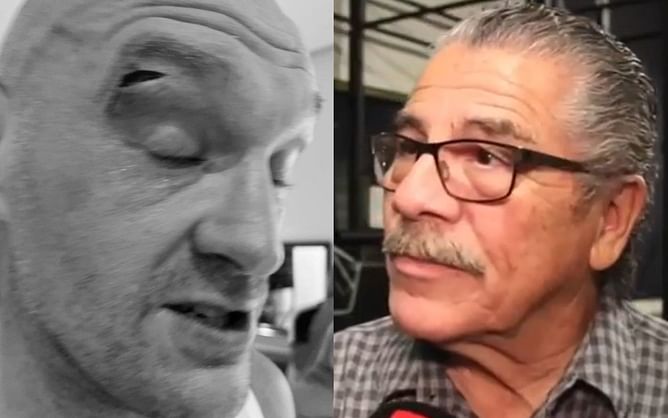 This one change can help Tyson Fury prevent horror cuts in sparring, says veteran cutman Jacob 'Stitch' Duran