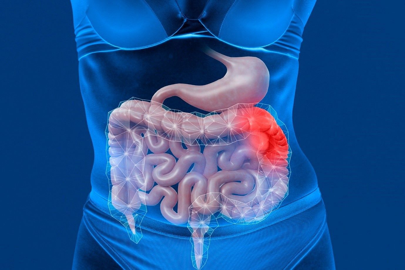 What is gut inflammation? (image by freepik)