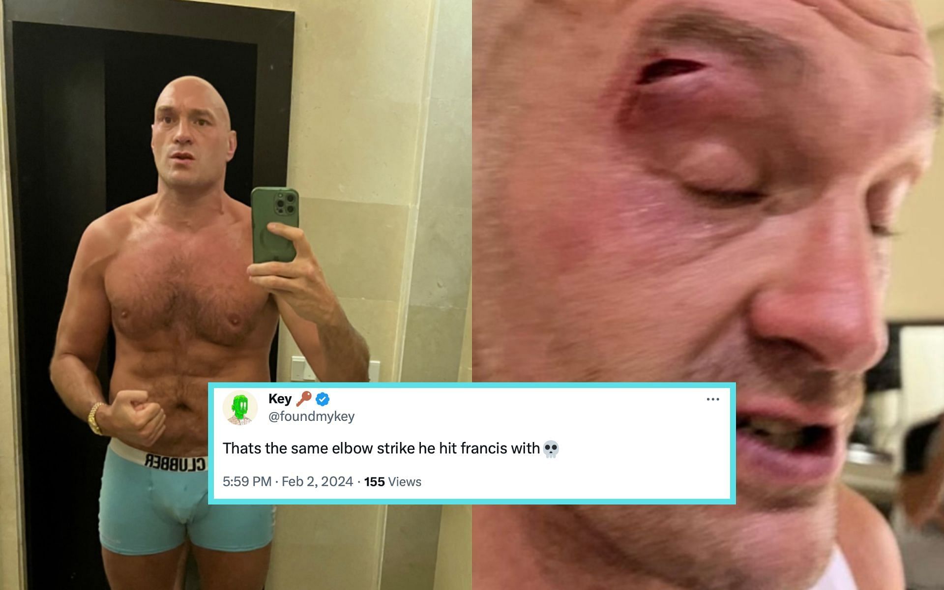 Fans react to video footage of Tyson Fury