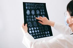Jesse Shipley brain: All we know about the unique case