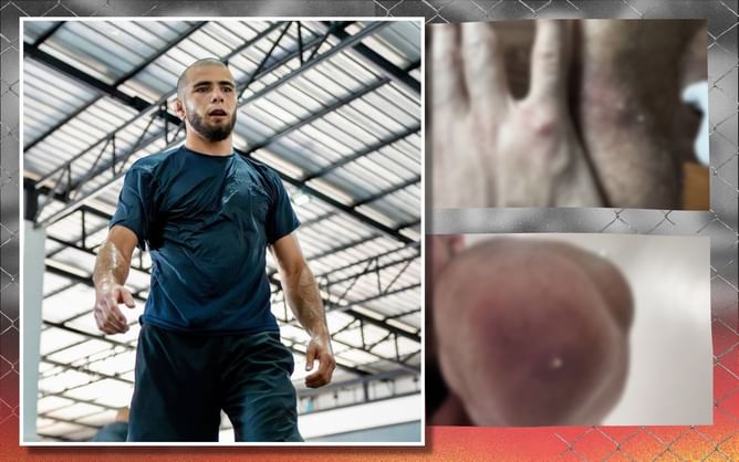 PHOTOS: Muhammad Mokaev leaks doctor's chat on gnarly staph infections "3 weeks out", sparks response from Laura Sanko with "throw-up" comment