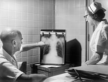 Lung abscess: Causes, symptoms and treatment