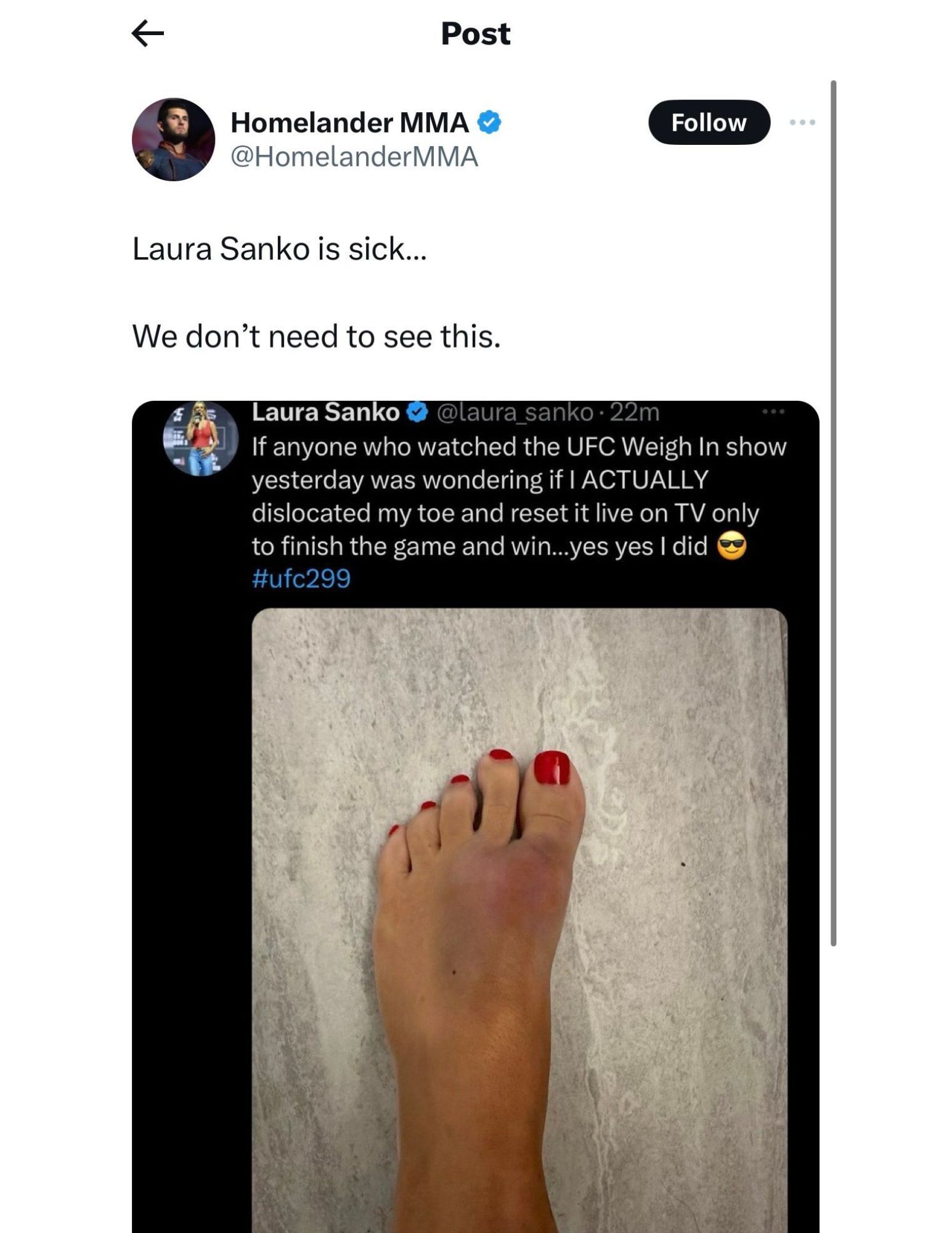 Fan responding to Laura Sanko posting her toe injury on X [via @homelandermma on X]