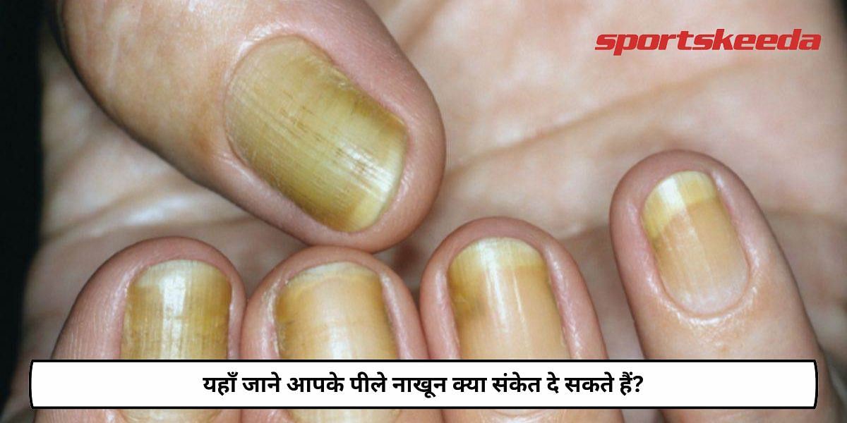 What Can Yellow Nails Indicate?
