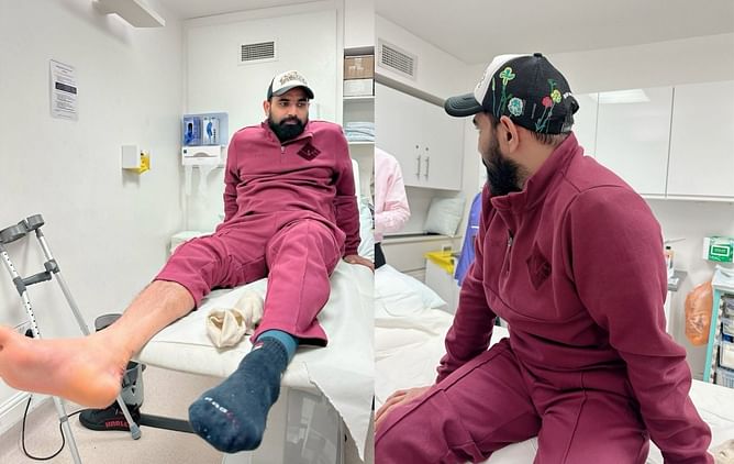 “Recently had my stitches removed” - Mohammed Shami shares update on recovery progress post surgery
