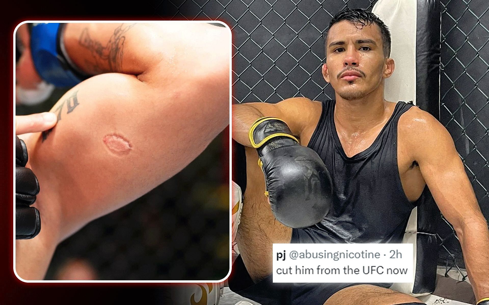 Fans react to Igor Severino (right) biting his opponent arm (left) [Images via: @ufc and @igorseverino_ufc on Instagram]