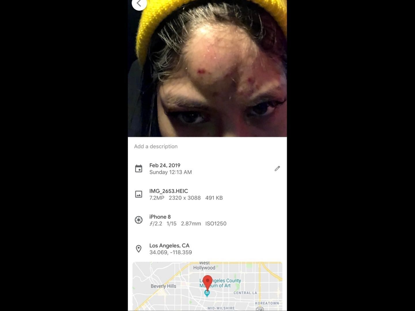 The alleged victim shared screenshots of her injuries from Xavier Wulf&#039;s physical abuse. (Image via Reddit/@gianyasami)