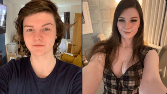 F1NN5TER before & after: How does the Twitch streamer look after