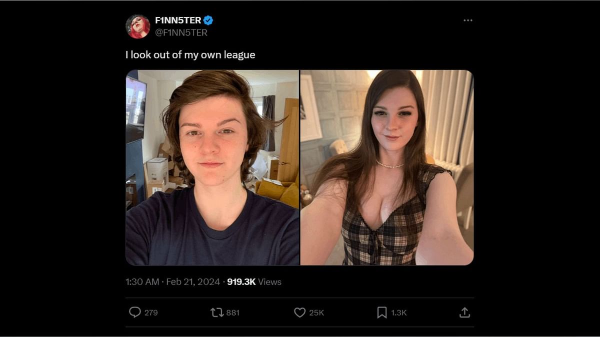 F1NN5TER before & after How does the Twitch streamer look after(02)