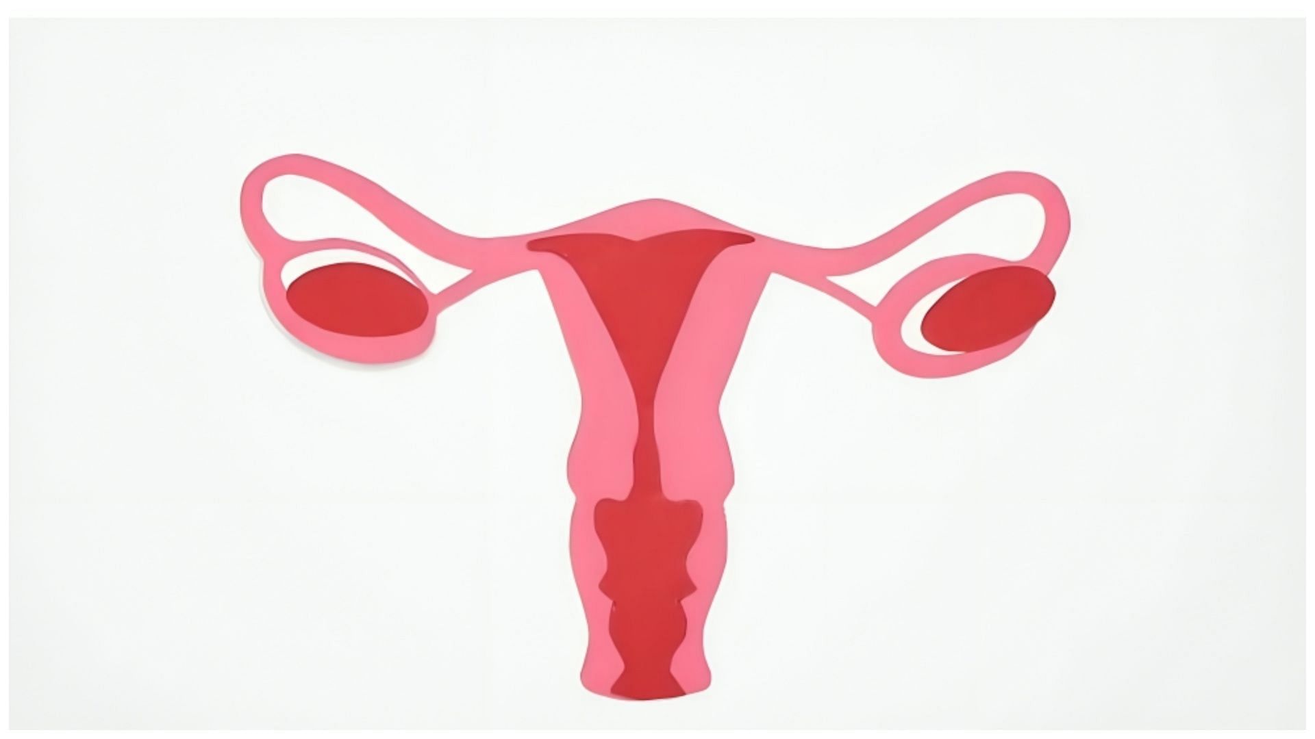 Endometriosis affects the ovaries (Image via Pixels)