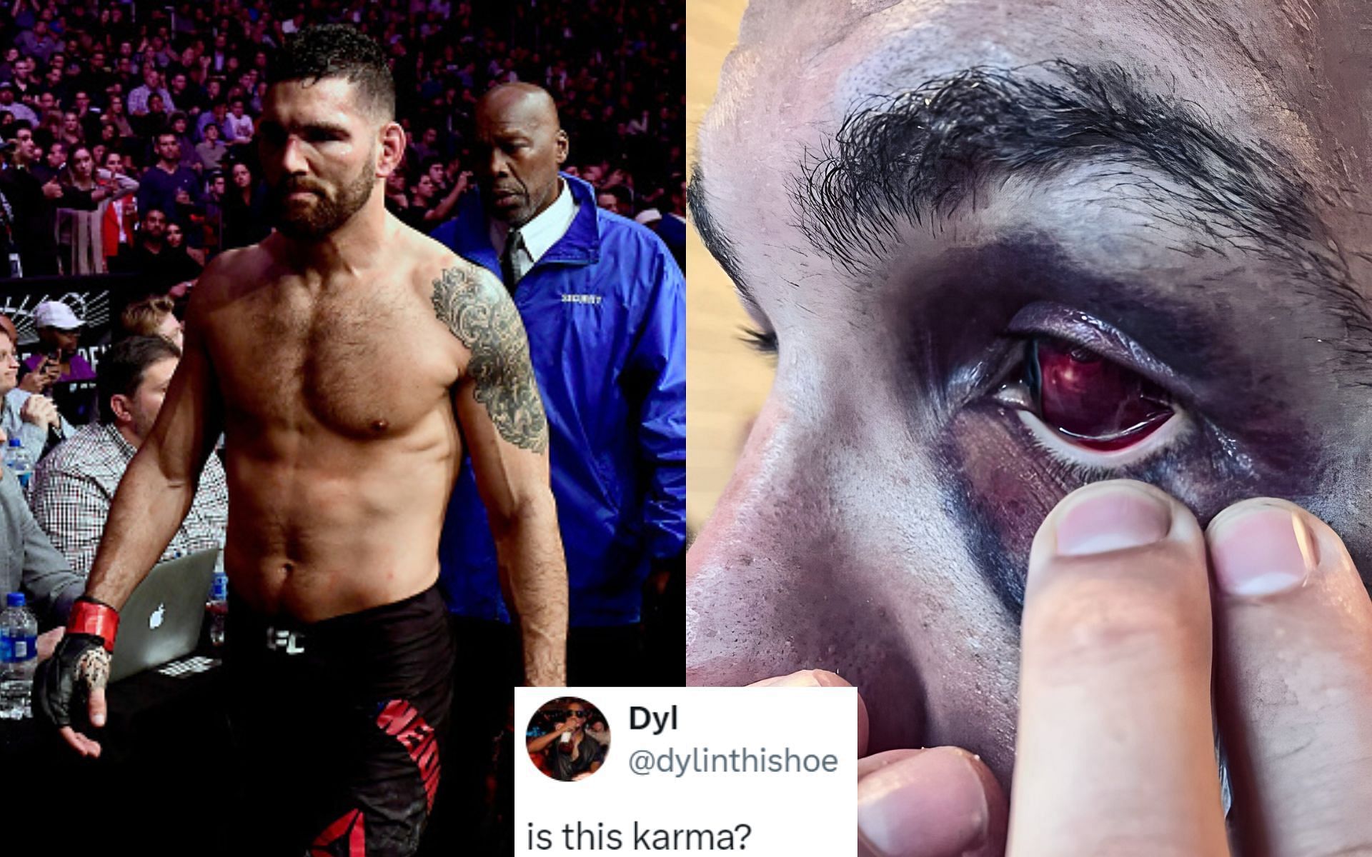 Chris Weidman reveals eye injury suffered against Bruno Silva