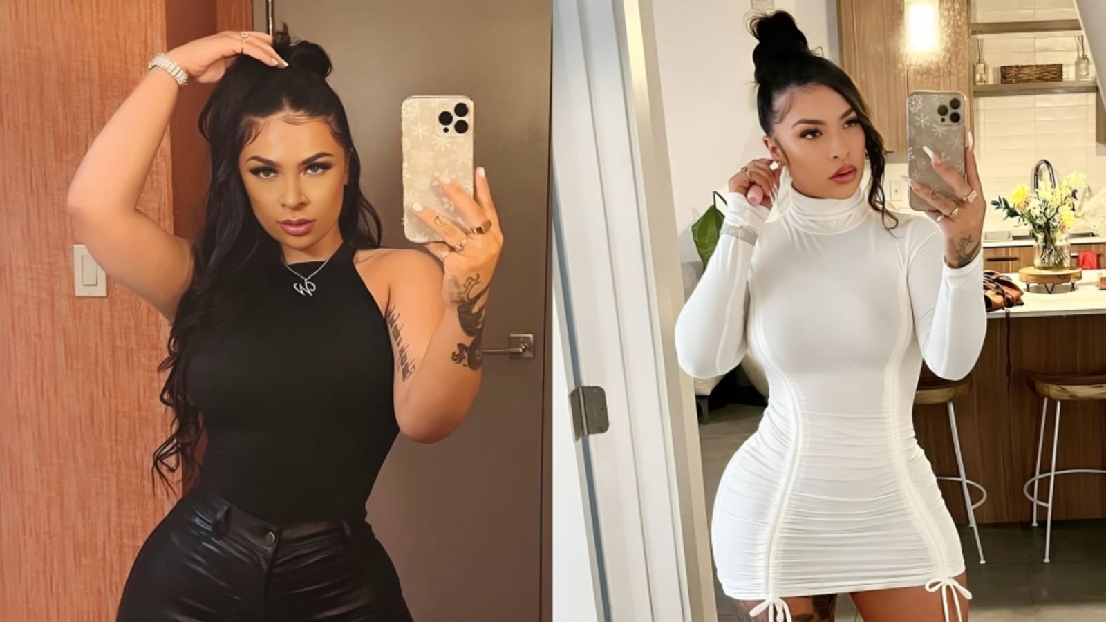 What does TMJ mean? Winter Blanco reveals effects of botched veneers procedure in tearful video