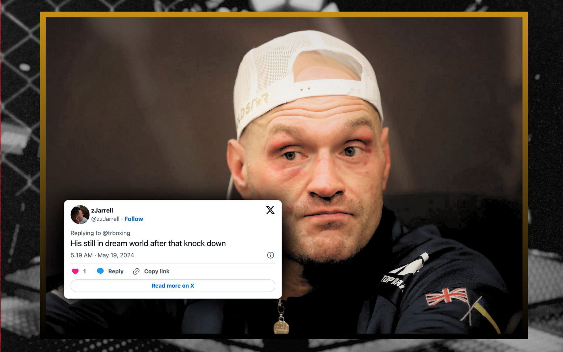 Tyson Fury receives backlashes for blaming Ukrainian war as the reason behind his loss. [Image courtesy: Getty Images]