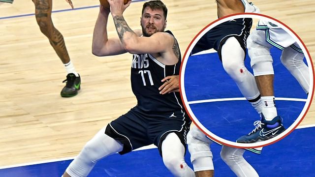 Why does Luka Doncic's knee bleed often? Exploring possible reason ...