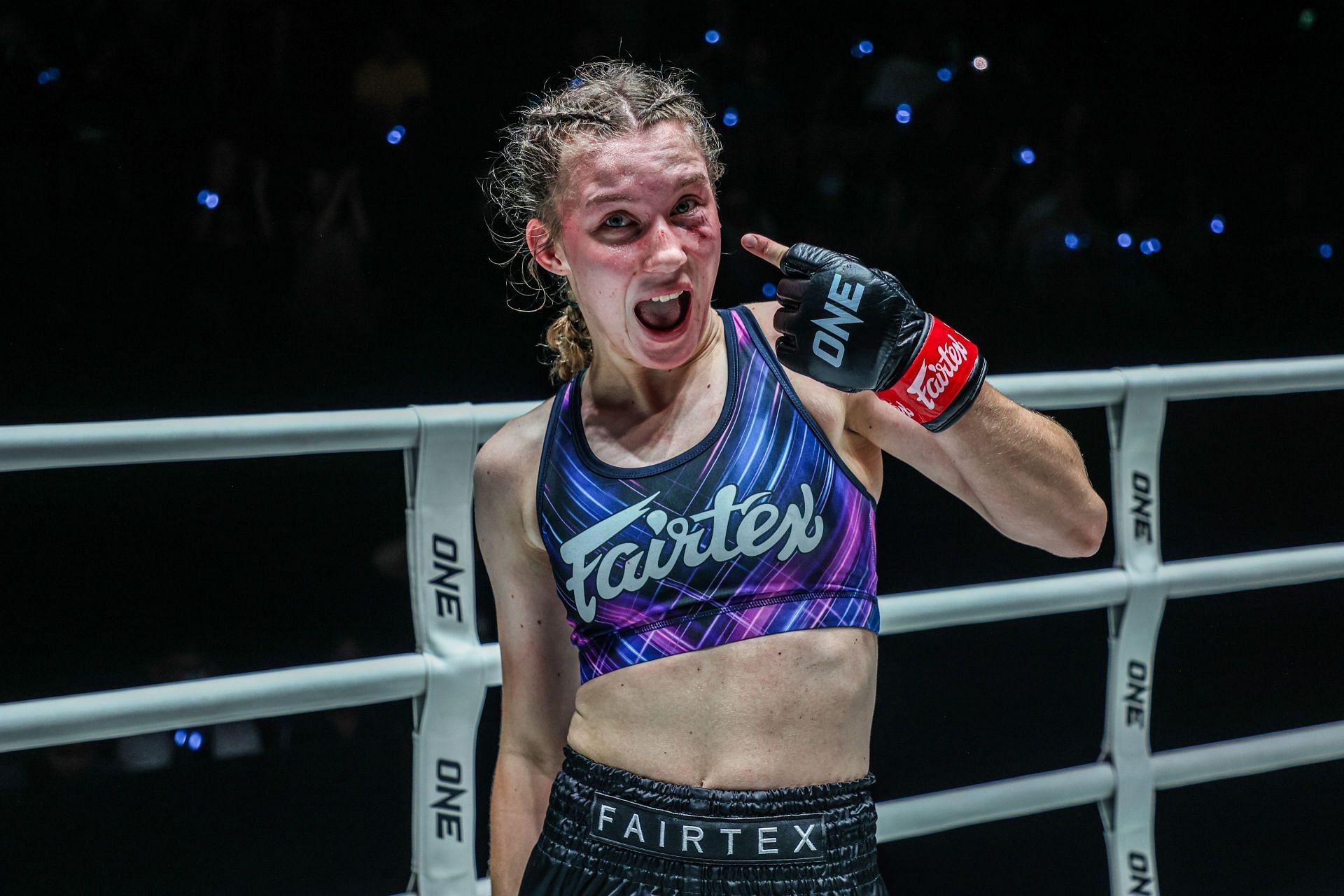 Smilla Sundell shows off her badly-bruised left eye after finishing Natalia Diachkova at ONE Fight Night 22.