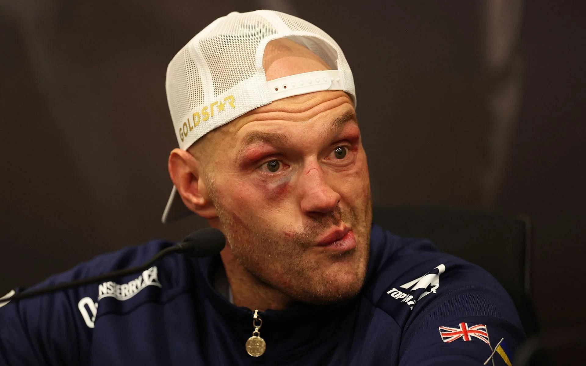 Tyson Fury reacts to the judges