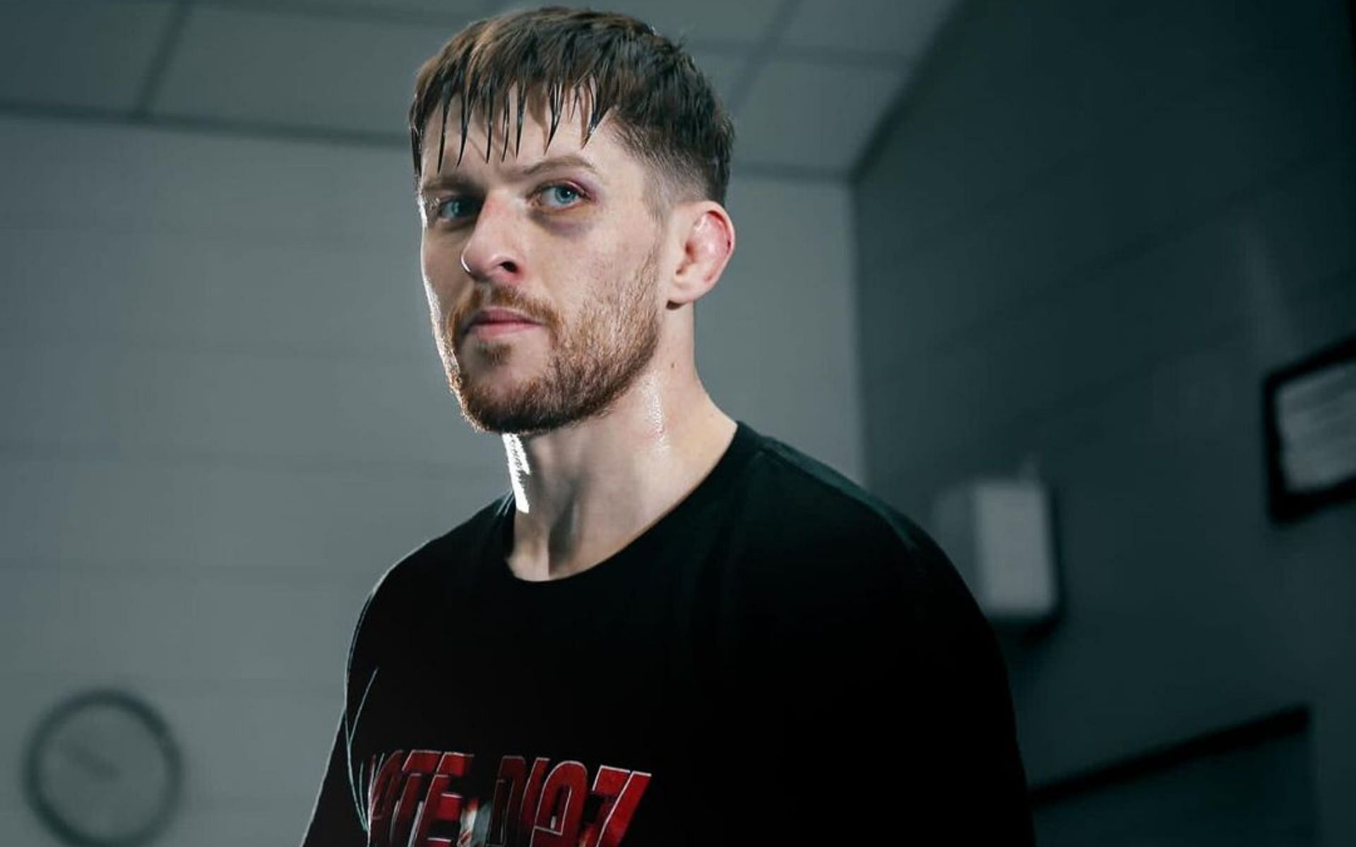 Jack Shore excluded from 180-Day medical suspensions post UFC 301 despite suspected fracture