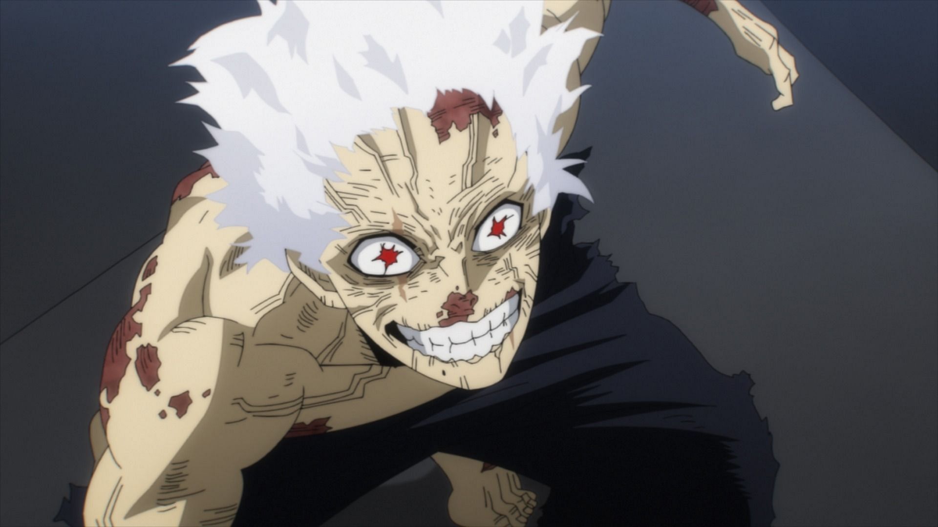 Shigaraki Tomura as seen in My Hero Academia season 7 episode 2 (Image via BONES)