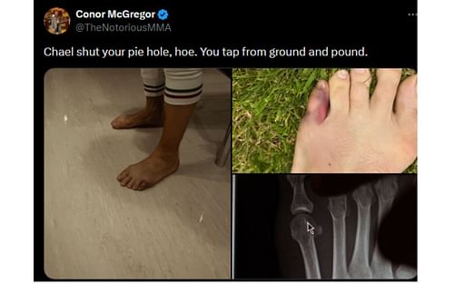 McGregor's tweet regarding his injury and Sonnen [Image courtesy: @TheNotoriousMMA - X]