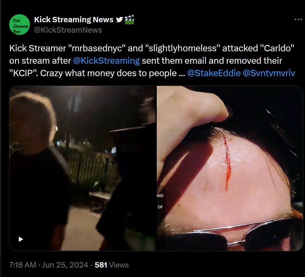 Slightly Homeless and MrBasedNYC attacked another streamer (Image via @KickStreamNews/X)