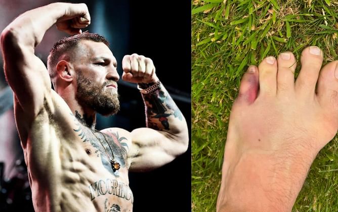 Chael Sonnen questions authenticity of "pimp" Conor McGregor's injury that caused him to withdraw from UFC 303
