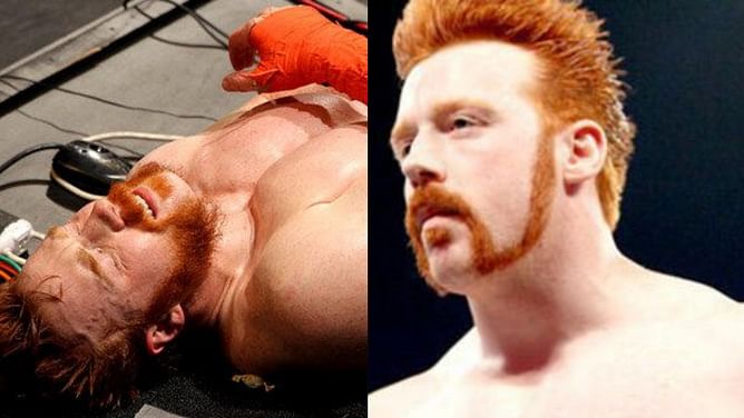 Sheamus was hurt after recent appearance on WWE RAW