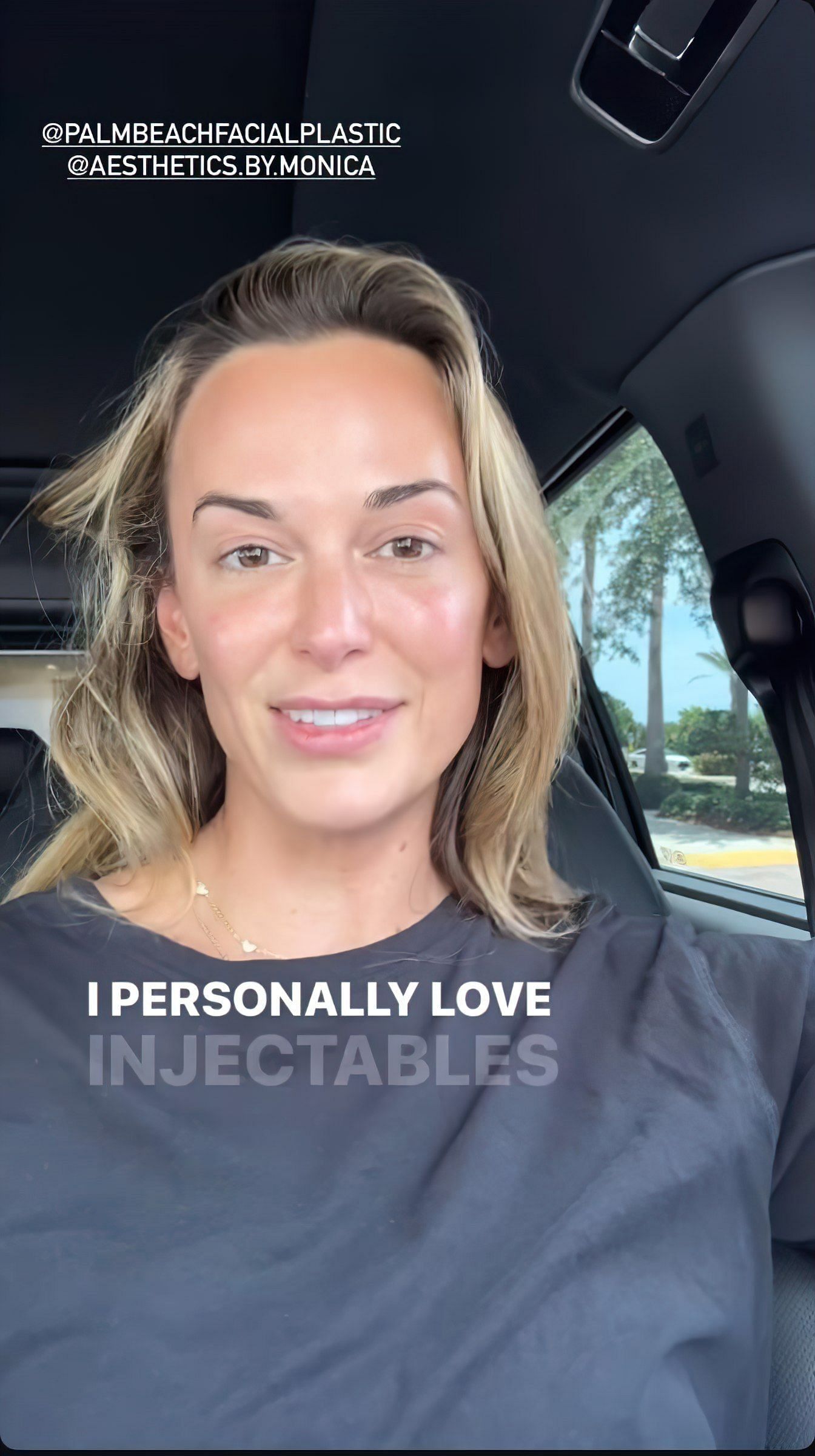Jena Sims gets Botox with injectables and shares her experience on Instagram. Image via @jenasims
