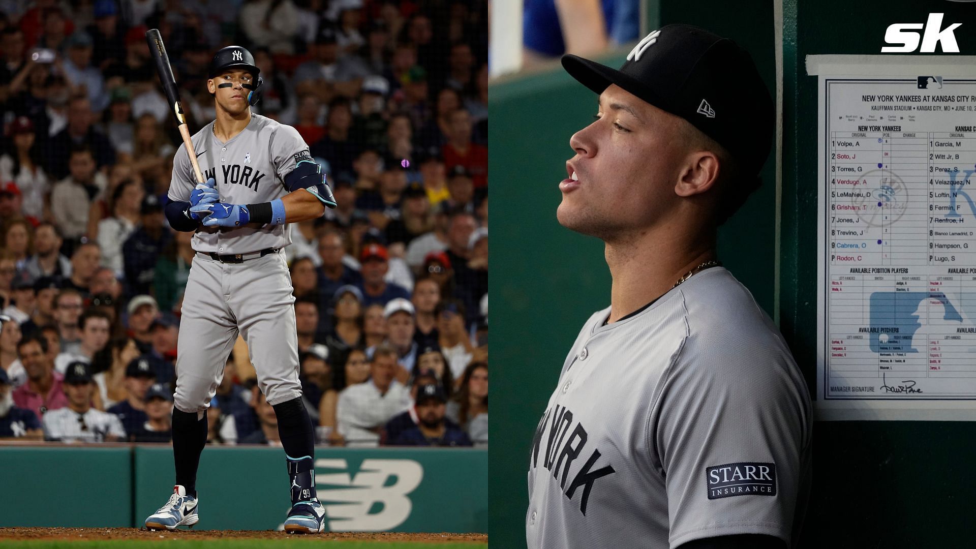 Aaron Judge Injury Update Yankees captain relieved as Xrays and CT