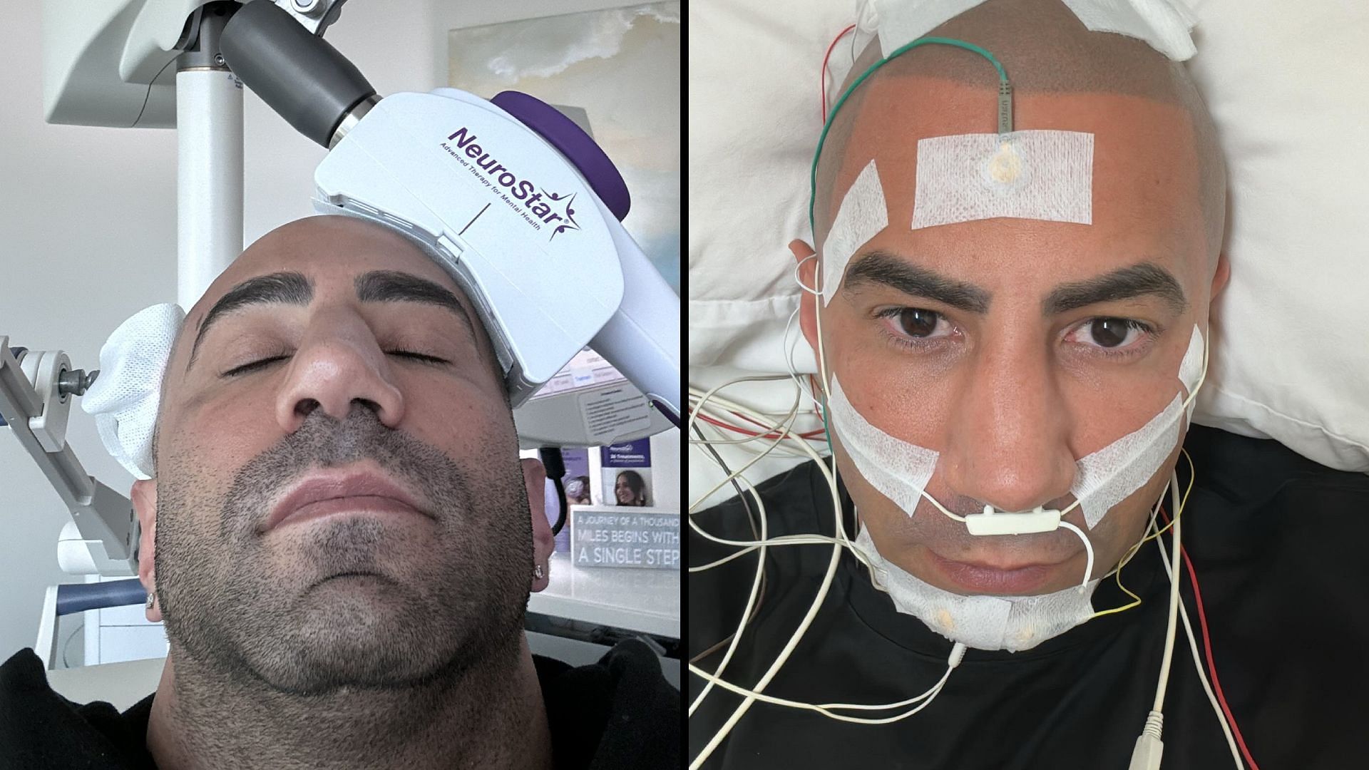 Fousey opens up about struggling with mental health issues (Image via Fousey/X)