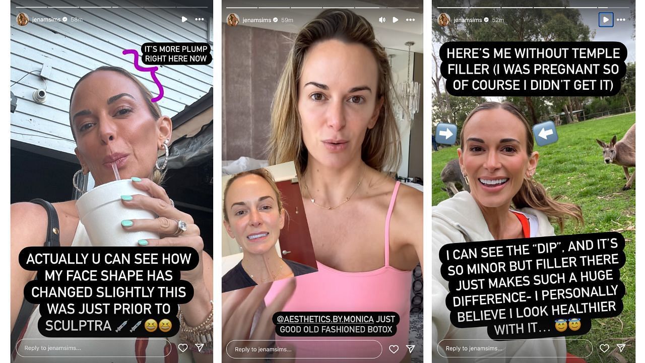 Jena Sims shared before and after photos from Botox surgery (Credit: jenamsims on Instagram)