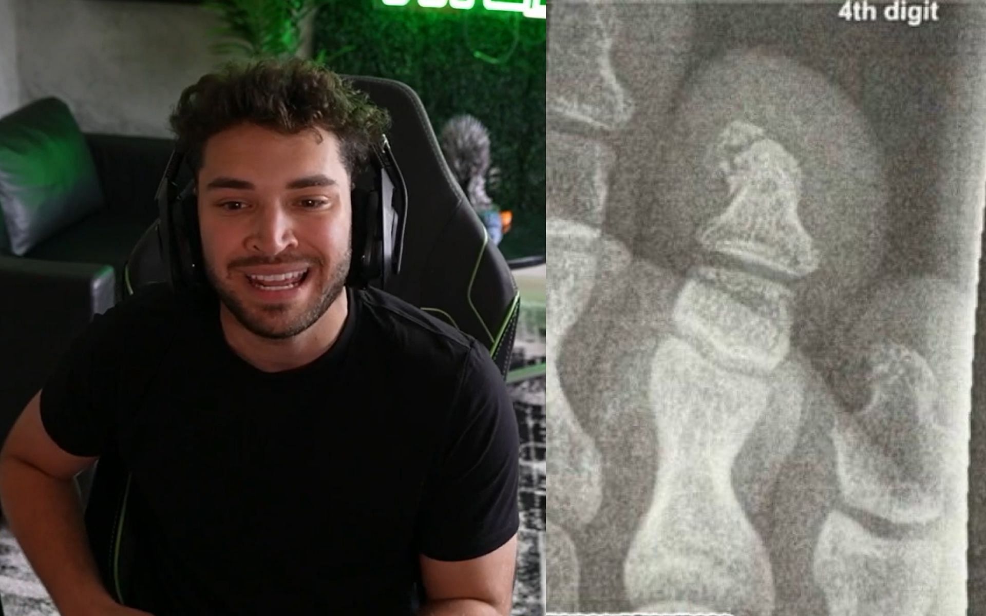 Adin Ross reveals how he broke his toe in a recent health update