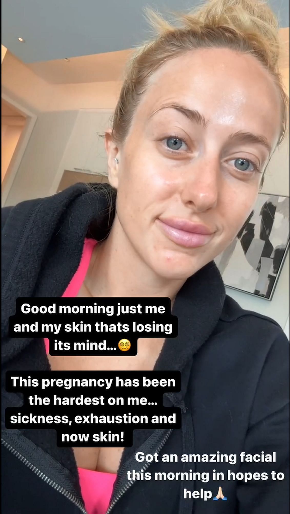 Brittany Mahomes discusses the hardships of her current pregnancy