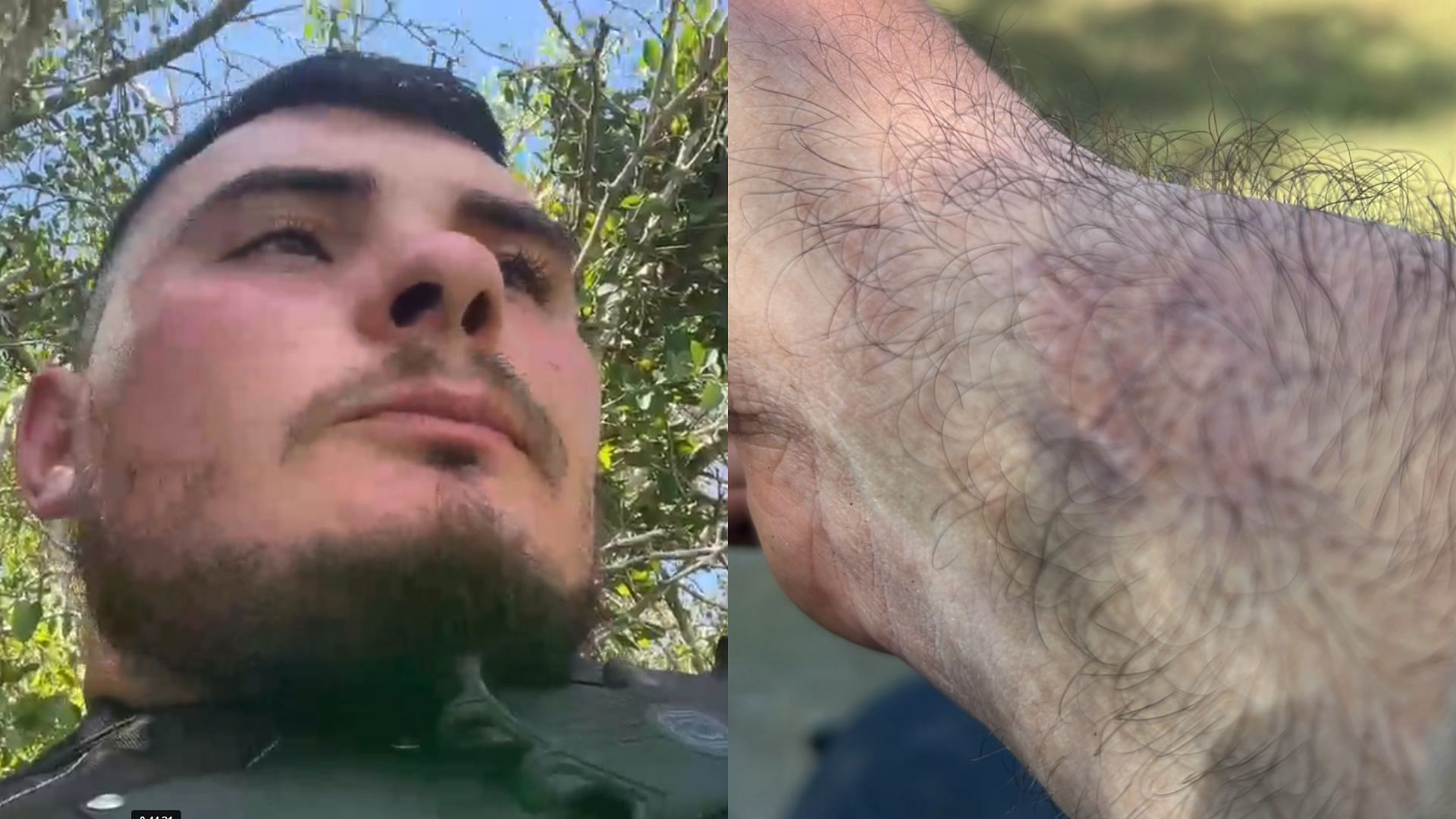 Kick content creator DR_BEATS was bitten by a fellow contestant during IcePoseidon