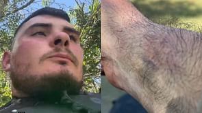 A participant bites another during Ice Poseidon's Hunger Games broadcast