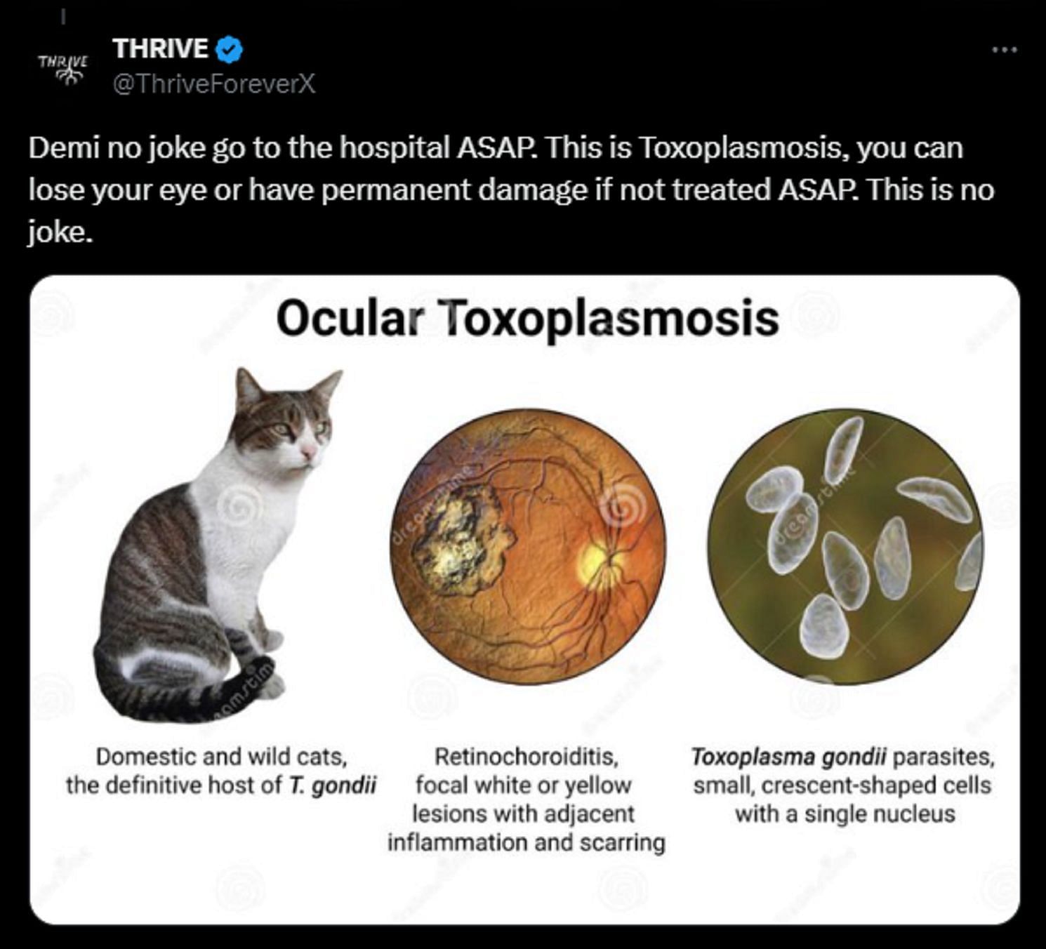 One fan suggests that she may have Toxoplasmosis (Image via X)