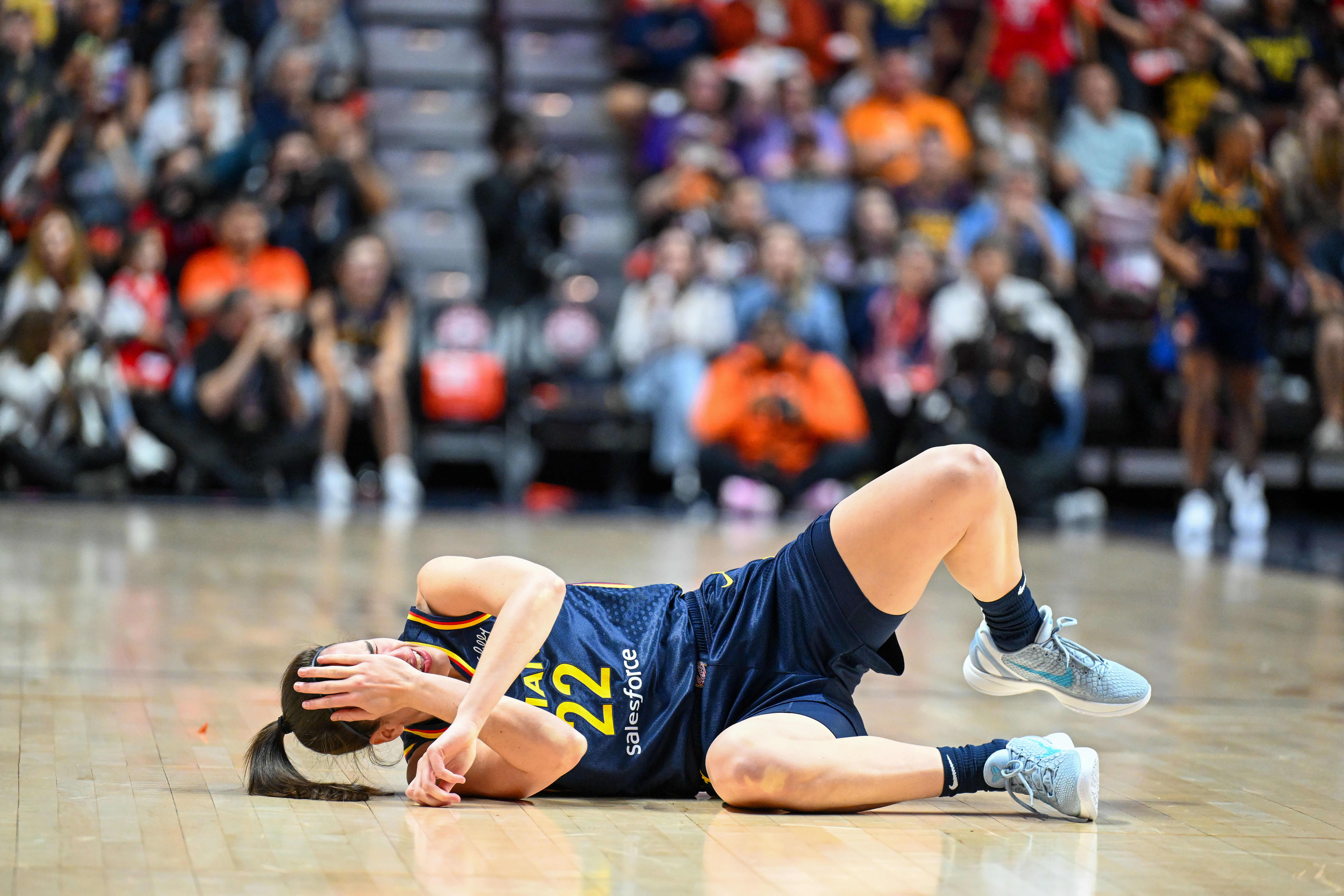 Caitlin Clark doesn&#039;t blame black eye for poor game. (Photo: IMAGN)