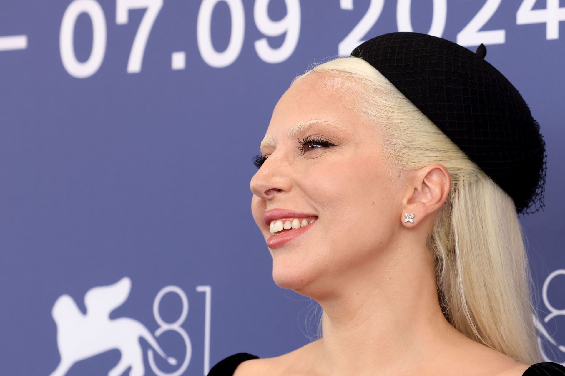 &quot;Joker: Folie A Deux&quot; Photocall - The 81st Venice International Film Festival - Source: Getty