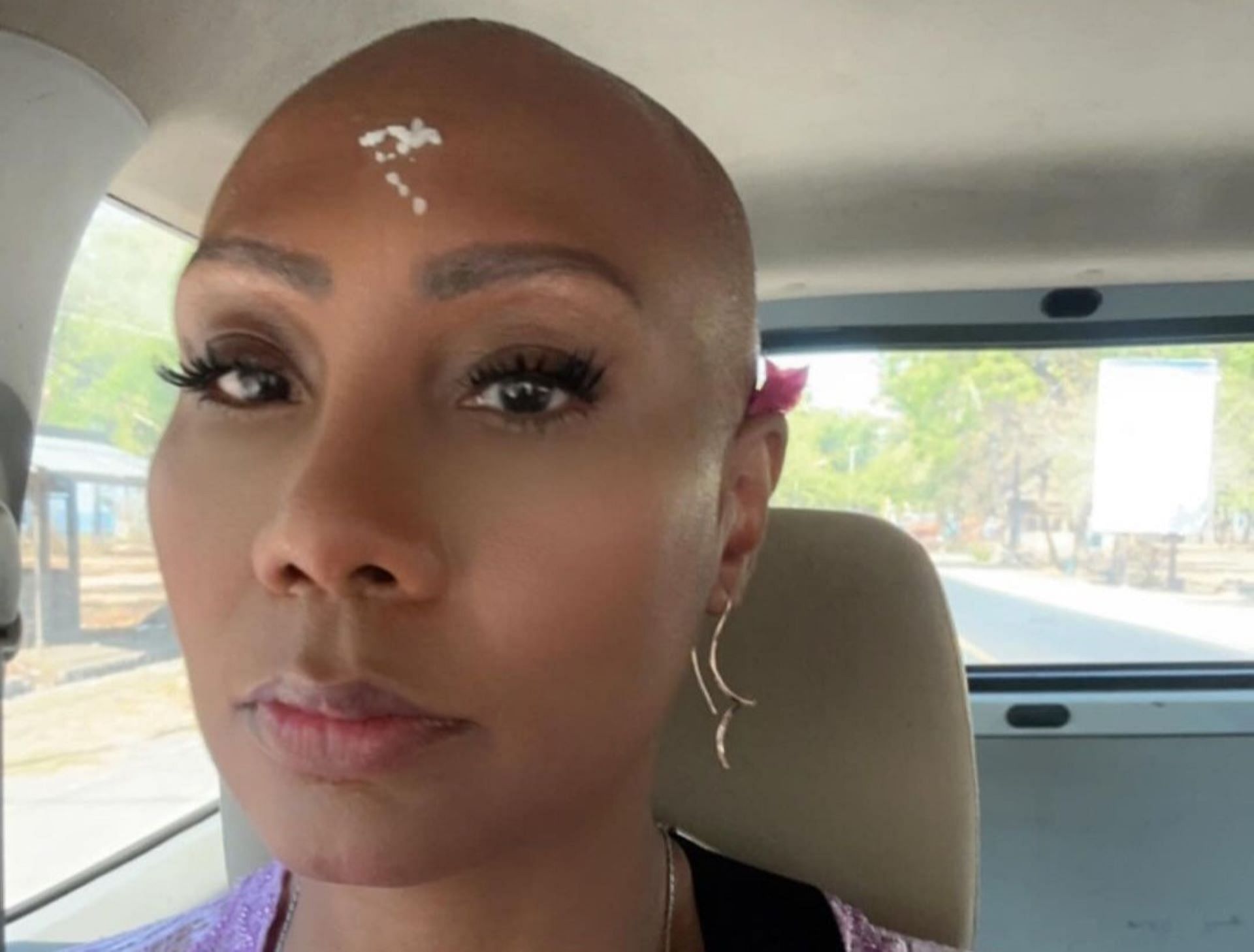 Towanda Braxton opens up about her hair loss journey in The Braxtons episode 7