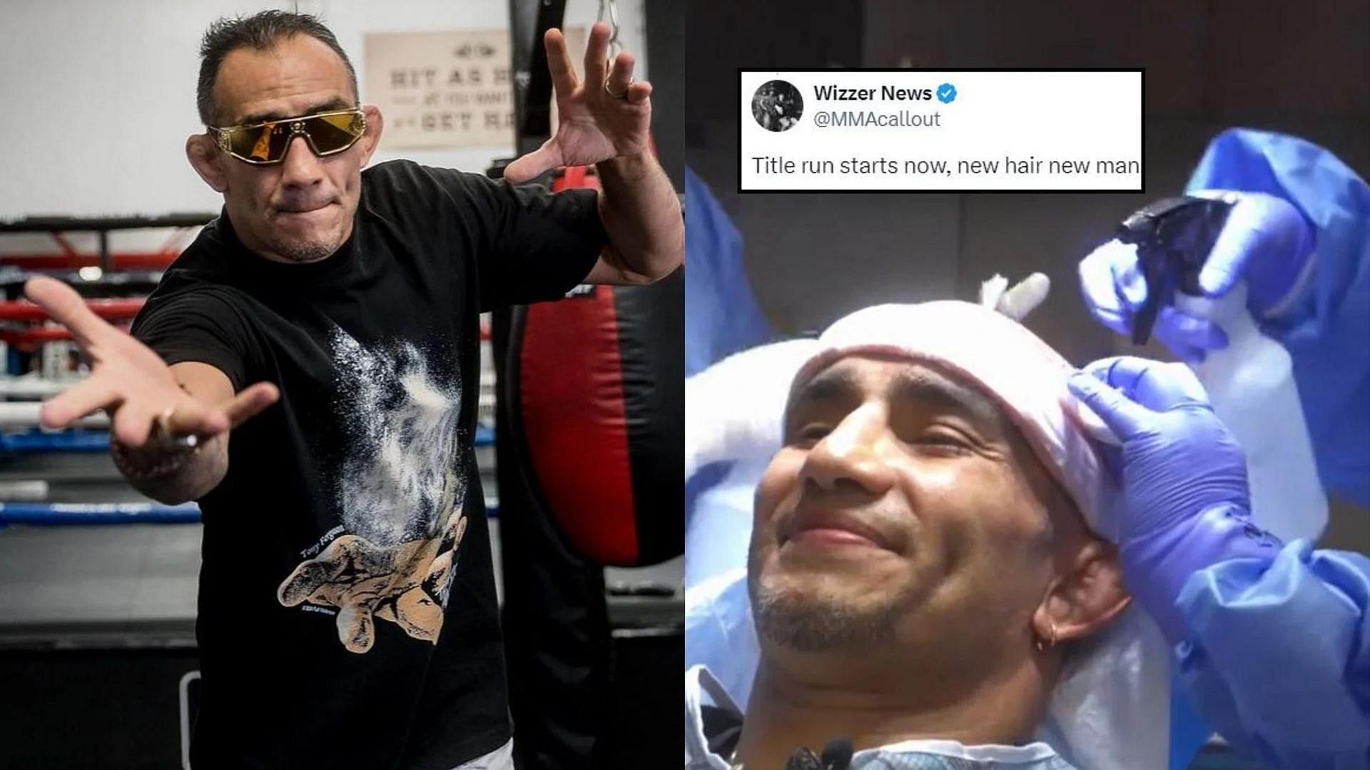 Fans react to Tony Ferguson (left) and his new hair transplant procedure (right). [Image credit: @tonyfergusonxt on Instagram, @TonyFergusonXT on X]