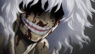 Shigaraki's Decay Quirk twist might have hurt his character (Image via Bones).