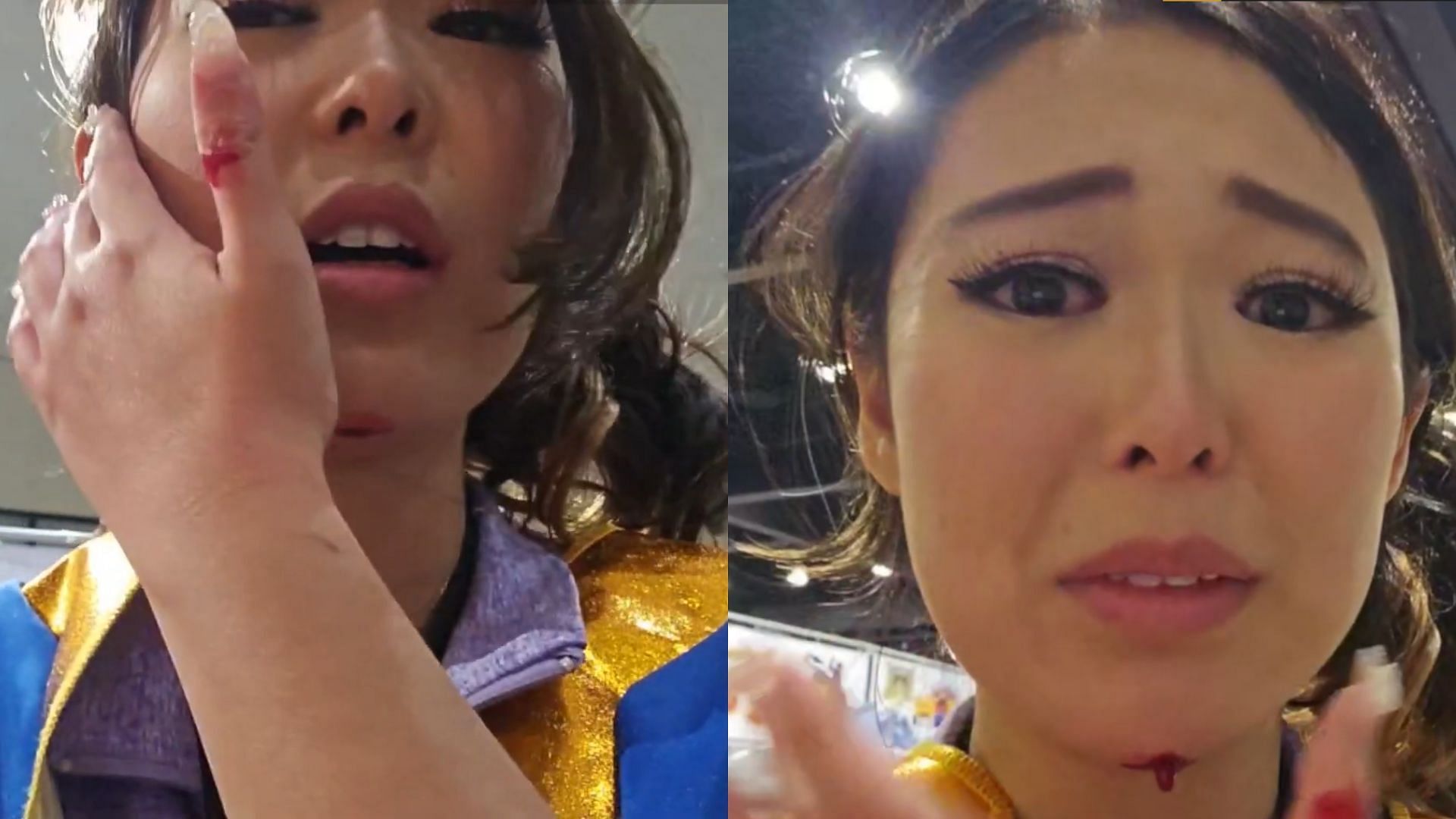 ExtraEmily was bleeding after injuring her chin at the LA Comic Con (Image via ExtraEmily/Twitch)