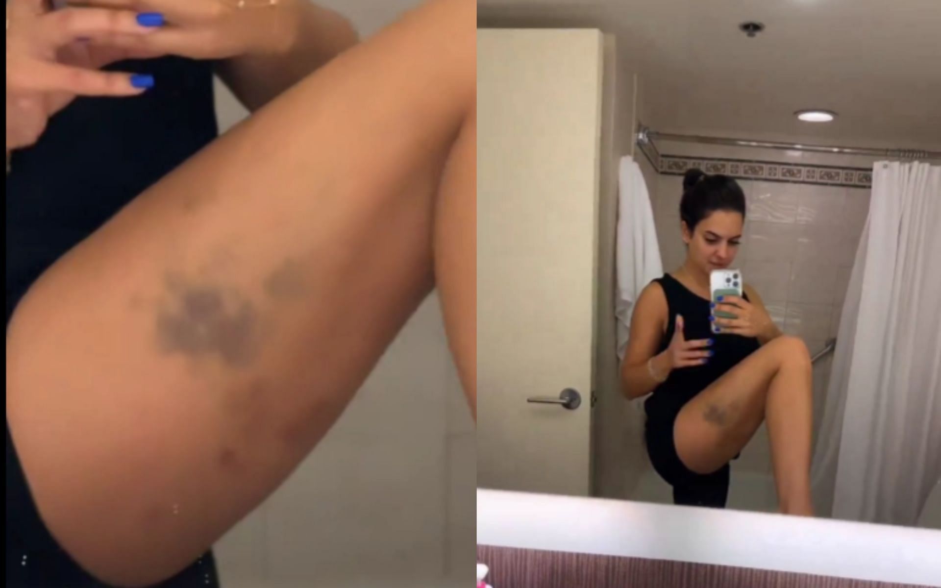 Nina-Marie Daniele shows off bruises from training with Alex Pereira [Images courtesy: @ninamdrama on X]