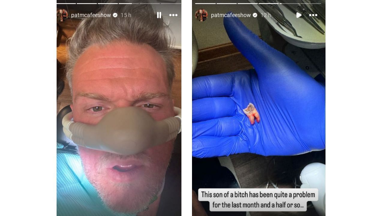 McAfee posted updates on IG about his visit to the dentist. (Source: IG- Pat McAfee Show)