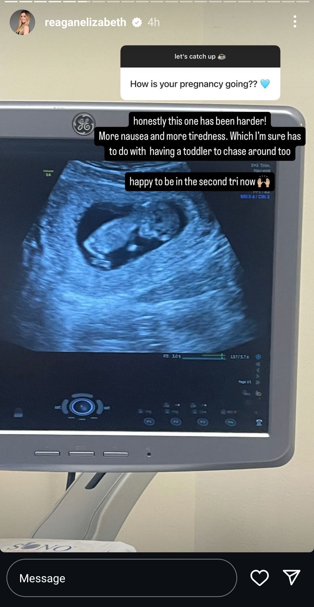 Alex Bregman&#039;s wife Reagan shares her second pregnancy struggles. Source - Instagram