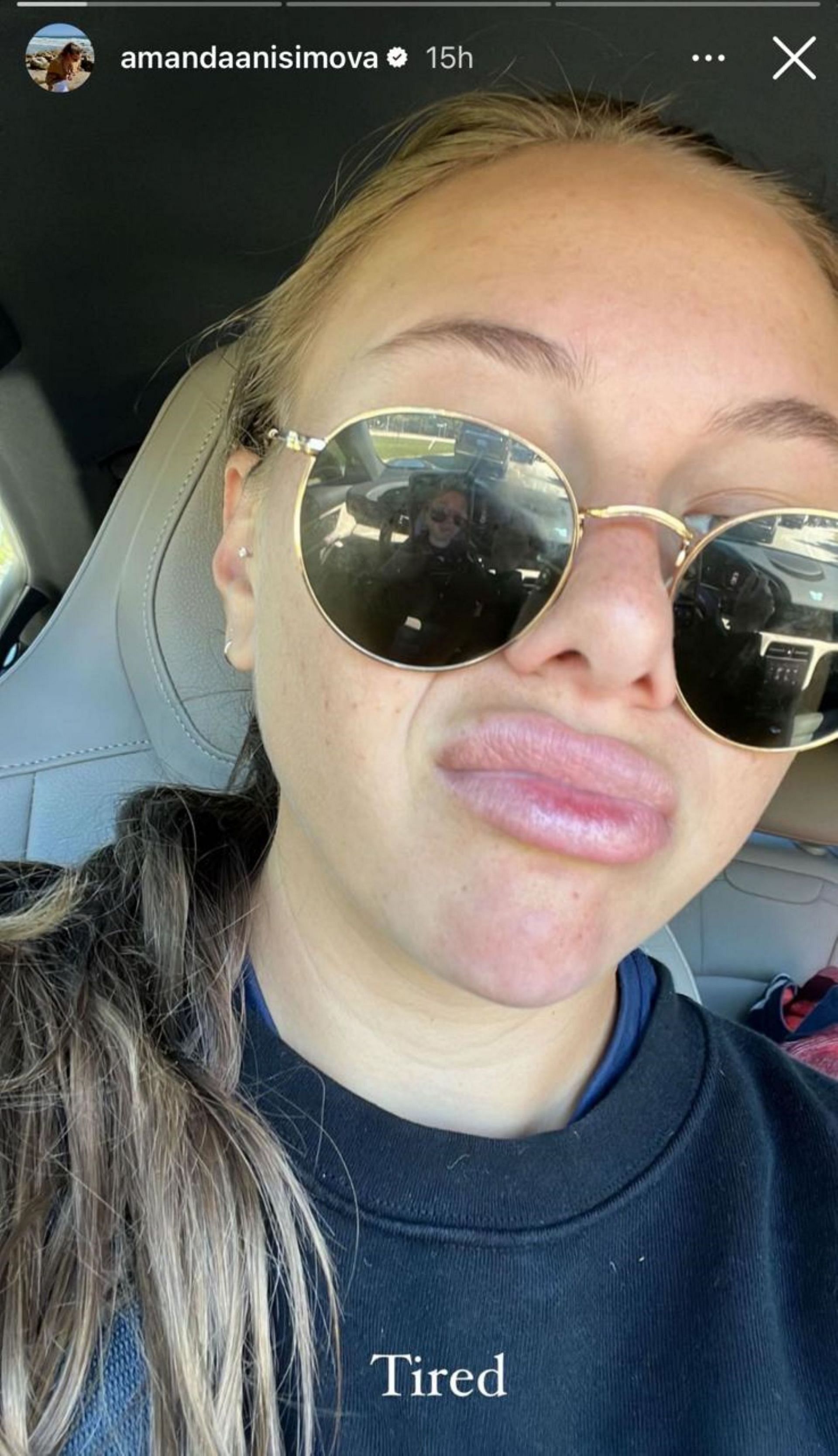 Amanda Anisimova poses for a no-makeup selfie; Instagram - @amandaanisimova