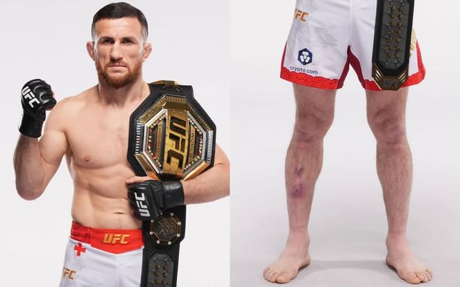 Merab Dvalishvili may have already leaked mystery injury teased ahead of UFC 311, seemingly caused by drunk assailant