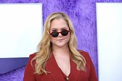 What is Cushing Syndrome? Cause and meaning explored as Amy Schumer alleges trolls triggered health diagnosis