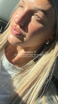 McCall Smith's pre-treatment look (Source: @mccallkelli via Instagram)